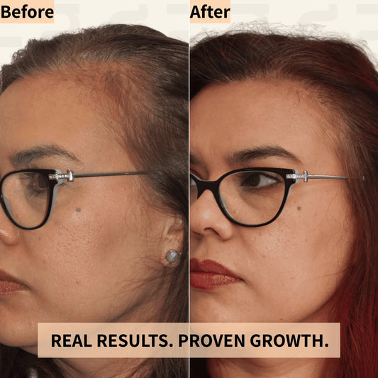 Fuller Hair in 8 Weeks - Scalp Massager